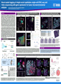 2025_AACR_Trekker spatial scATAC VDJ seq poster